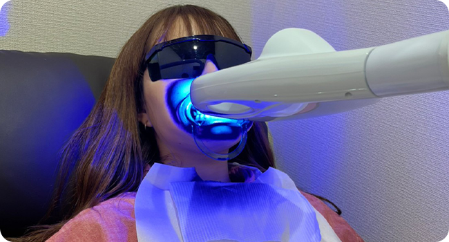 セルフホワイトニング施術イメージ