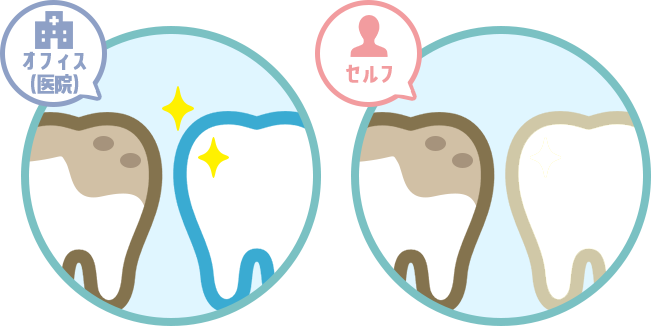 オフィス（医院）とセルフホワイトニング　イメージ