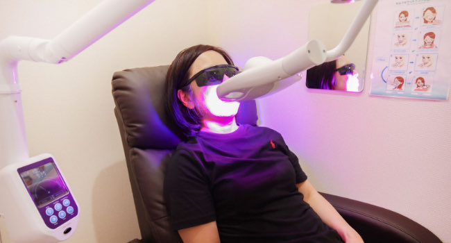 セルフホワイトニング　イメージ